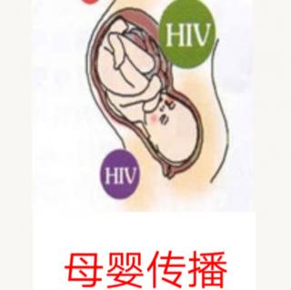 朗读 HIV感染母婴阻断