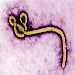 当今变异的埃博拉病毒究竟是自然进化还是人为？