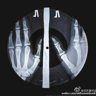 20160507（3）苏联X光片“人骨唱片”之歌