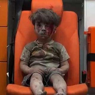 【时不时新闻】160822 令人心碎的叙利亚男孩
