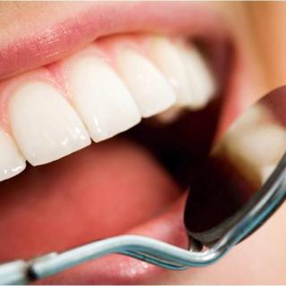 【美丽也是技术活】关于牙齿健康的5个常见问题