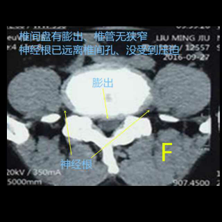 施晓阳汉阳针刀高徒群系列讲座41马鑫：影像在临床诊断中的作用