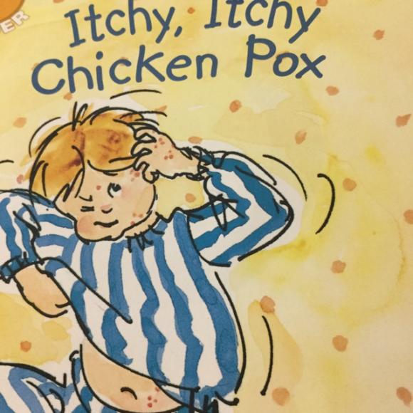 itchy itchy chicken pox
