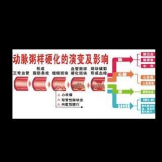 坚持记录学习营养知识第100天-动脉粥样硬化和冠心病