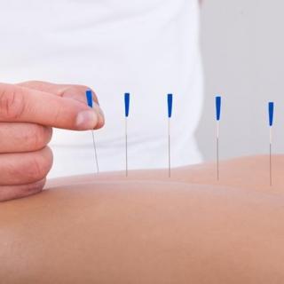 NO.288  老外侃中医（3）:Acupuncture is so much more than needles...