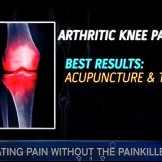 用针刺及太极止痛 Treating Pain with Acupuncture and Tai chi, without Painkills