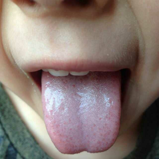 简单的舌诊1