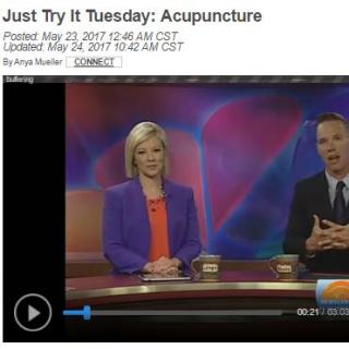 Just Try It Tuesday Acupuncture