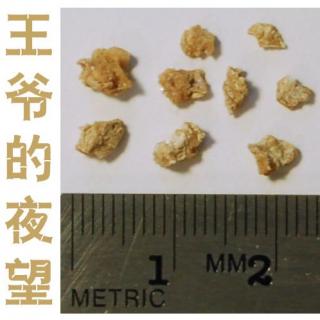 161-王爷的肾结石分析-王爷的夜望