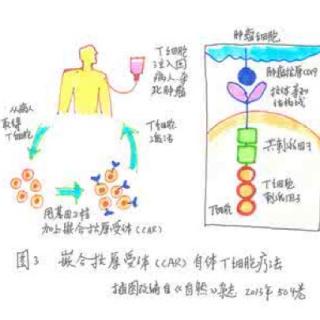 【Kris雅思晨读0613】ACT（CAR-T）疗法