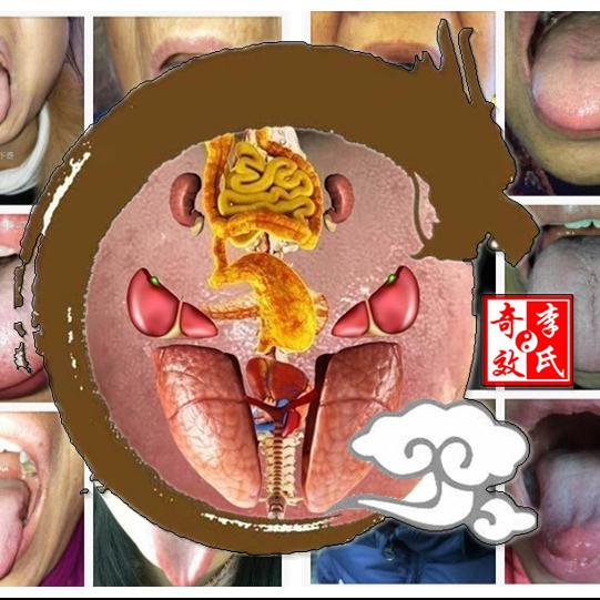【正常舌與舌診的注意事項(四)】在線收聽_李氏奇效醫學_荔枝fm