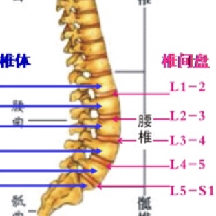 腰椎间盘突出的8个自我修复法(72)