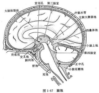 小脑扁桃体疝图片
