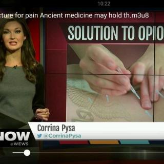 ABC 5 Cleveland: Acupuncture for pain Ancient medicine may hold the key to solving the ...