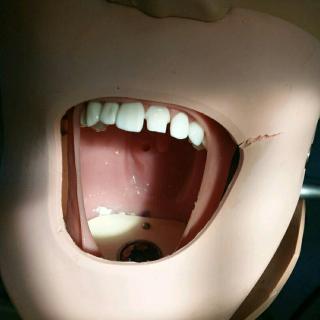 牙体缺损的修复（铸造金属全冠）