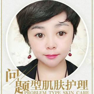 杨利花:问题型肌肤护理