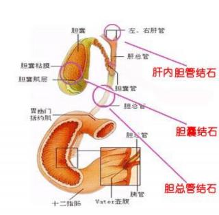 身体为什么会长石头？-胆结石篇