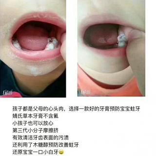 请注重孩子的牙齿口腔问题！
