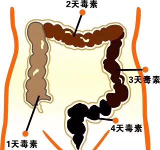 总是便秘怎么回事？