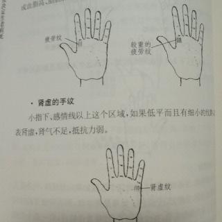 手纹诊病【2】