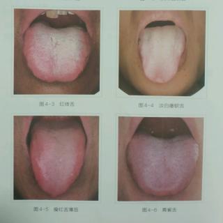 9种典型体质的舌象及其干预【一】