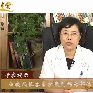 【中科白癜风】所有的白癜风都会长到脸上吗