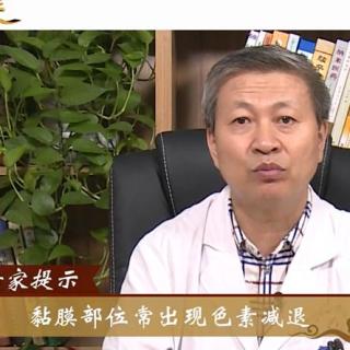 【中科白癜风】白癜风患者不只是皮损处脱色