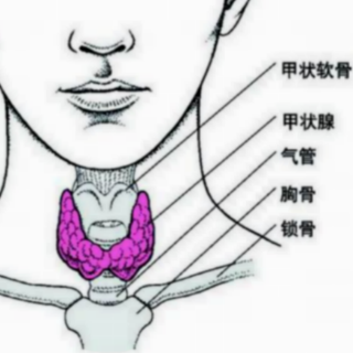 亚急性甲状腺炎怎么鉴别诊断？