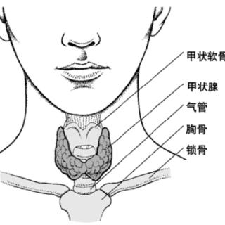 什么情况下需要实施甲状腺穿刺？