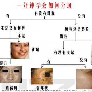 认识各类色素斑