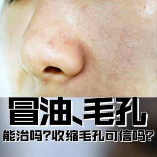 冒油毛孔粗大能治吗？控油收缩毛孔可信吗？杜青峰