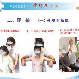 金针刀金泽明教授分享：肩关节外展受限的针刀治疗