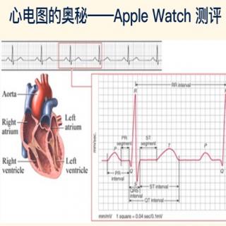 EKG and Apple Watch❤️心电图的奥秘