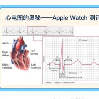 200318 EKG and Apple Watch