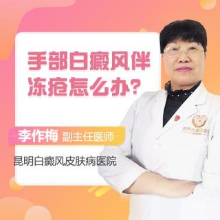 昆明白癜风主任医师李作梅讲解：手部白癜风伴冻疮怎么办？