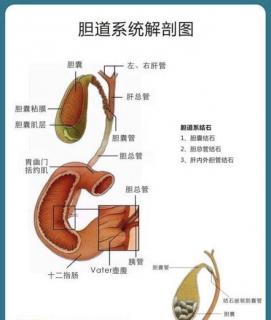 详解胆结石——成因，调理，预防