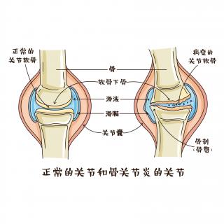 第7集 关节不适，中医这么说，西医那么说？