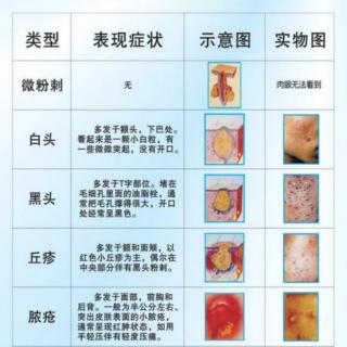 不要再手Y了，痤疮必看，发人醒思