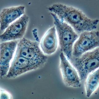 “永生”的海拉细胞，造福人类数十亿？！