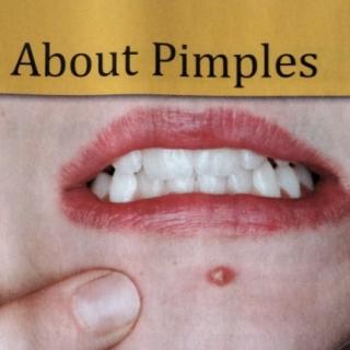Myths about pimple s!