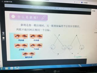 视疲劳的发病机制