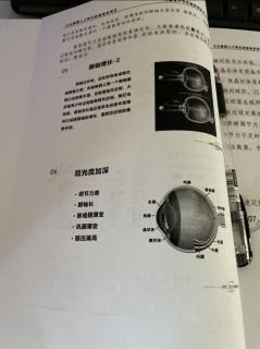 近视促进：不适宜的生活用眼t