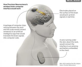 Mind-reading brain implant