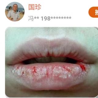 肝不好的人，面部会出现四种迹象，这是提醒你的信号……